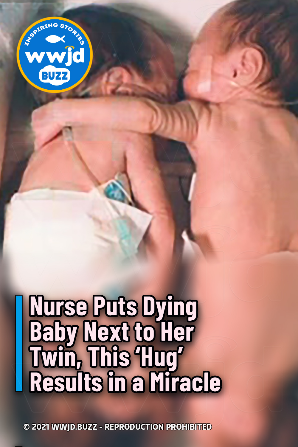 Nurse Puts Dying Baby Next to Her Twin, This ‘Hug’ Results in a Miracle